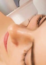 Endolift