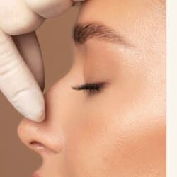 Estética facial