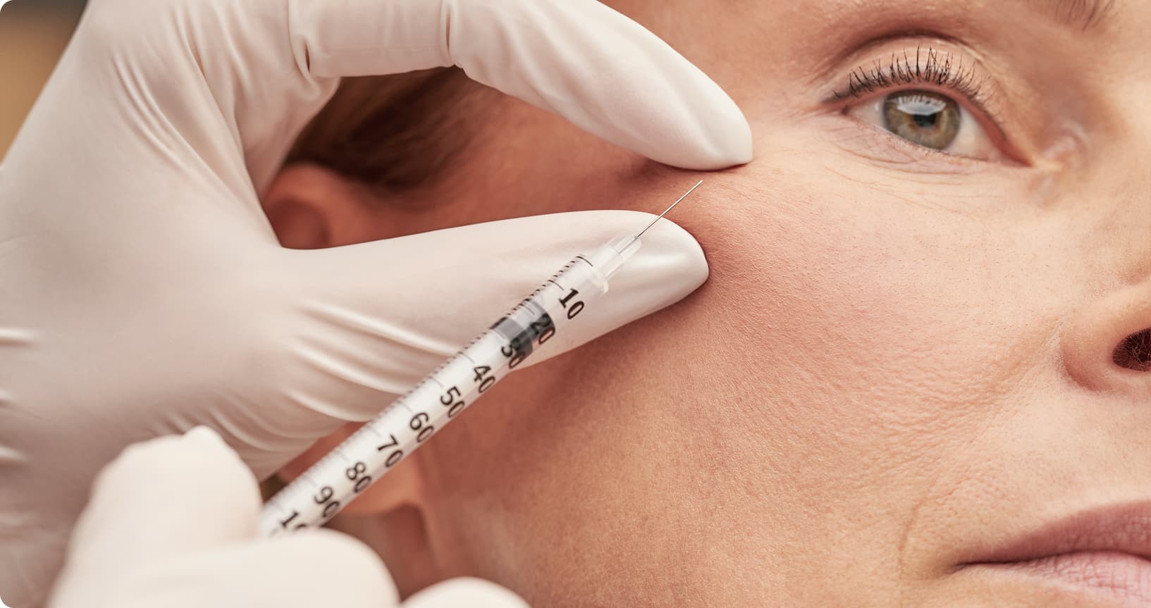 Medicina estética facial