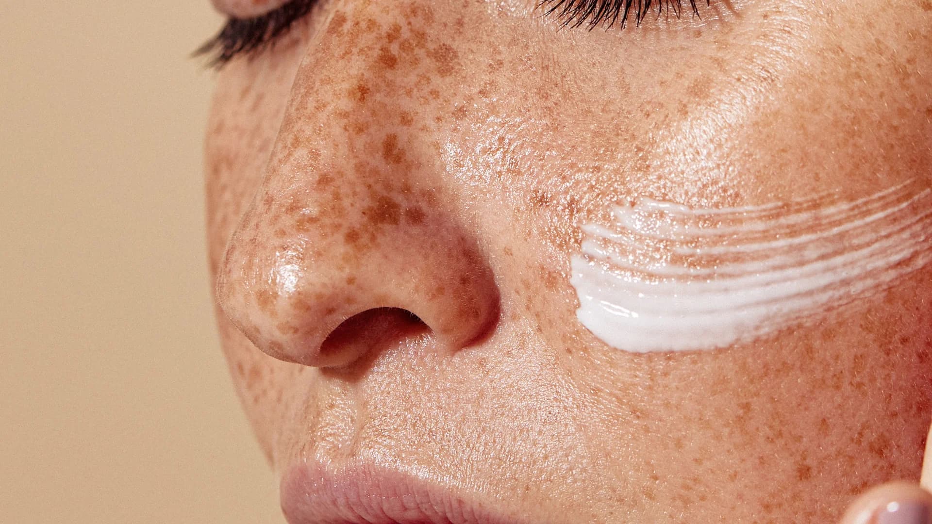 Dermatología estética